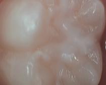 Sealant 1